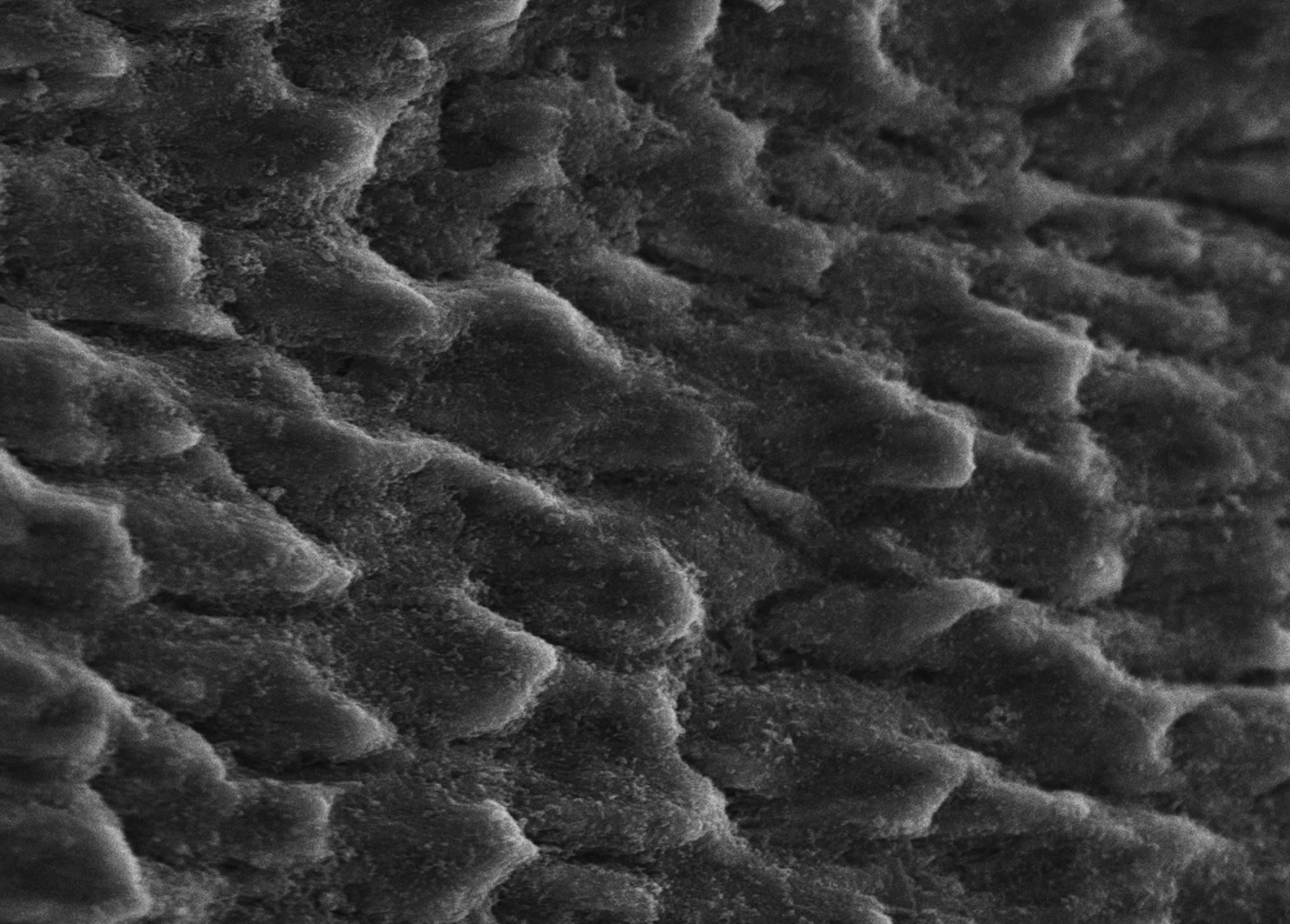 Can you really rebuild enamel? Rebuilding vs Regrowing.